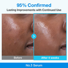 Numbuzin - No.3 Blue Bio-Retinol Pore Refining Serum