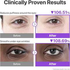 Numbuzin No.9 NAD+ Collagen Under Eye Patches 8g x 5 pairs