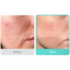 Medicube Azelaic Acid 16 BB Calming Serum (30mL)